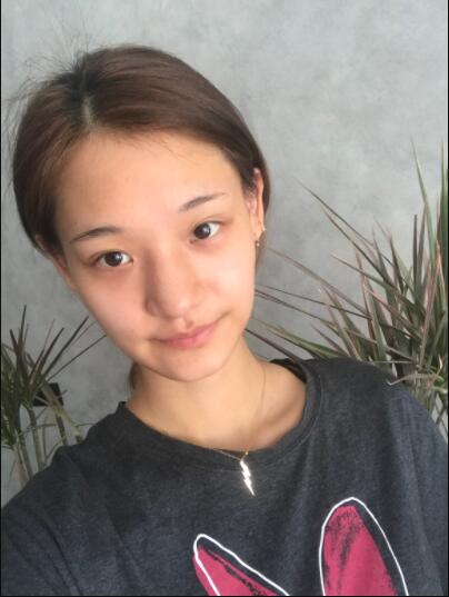 成都蜀尚蓉雅美容整形醫(yī)院做鼻綜合術前的鼻子