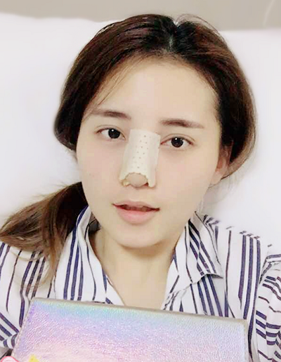 深圳微姿醫(yī)療美容門診部康壯為做鼻綜合案例效果分享