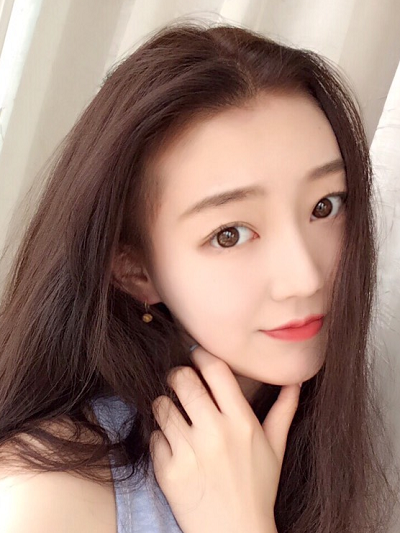 南京美貝爾醫(yī)療美容醫(yī)院黃名斗做自體軟骨隆鼻案例效果分享