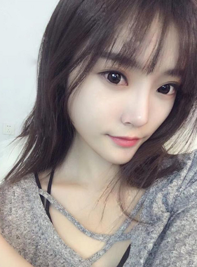 上海玫瑰醫(yī)療美容醫(yī)院做硅膠隆鼻手術(shù)后恢復(fù)情況