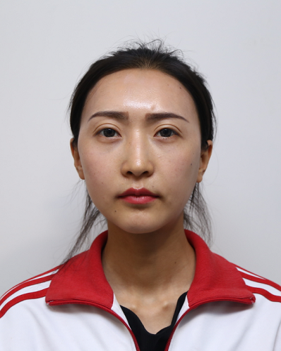 上海時(shí)光整形外科醫(yī)院王濤做顴骨整形案例效果分享